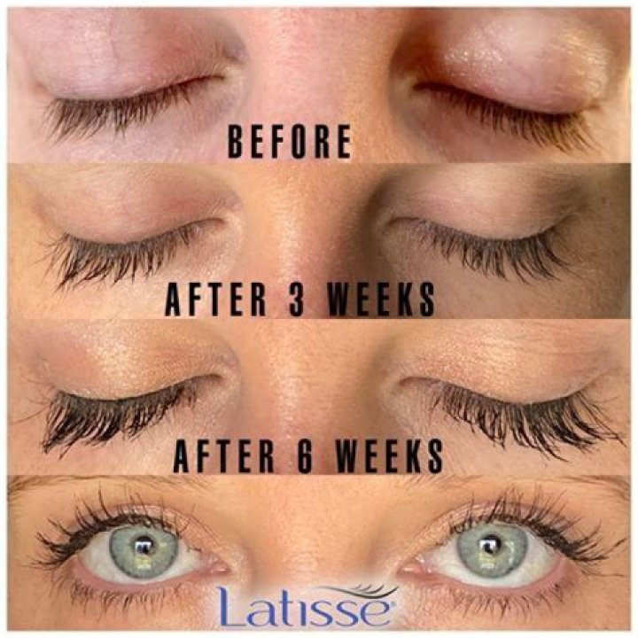 Discover Stunning Lash Transformations For Asian Beauty