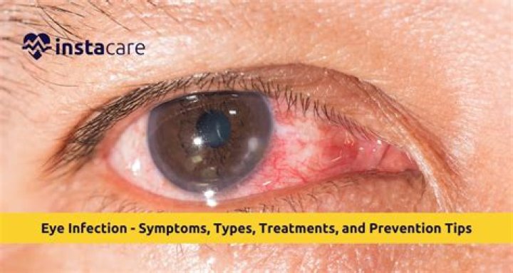 Keep Eye Infections and Irritation at Bay with Colloidal Silver